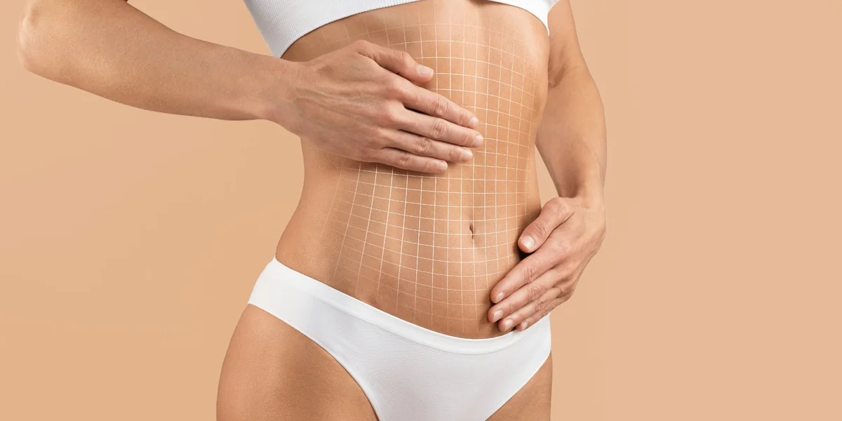 Tummy tuck surgery